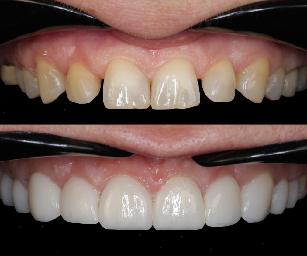 Cosmetic Dr. Zenonos – The Dental Clinic